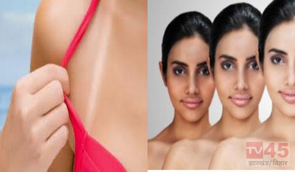 गर्मियों में टैनिंग क्यों होती है? जानिए टैनिंग से छुटकारा पाने के उपाय