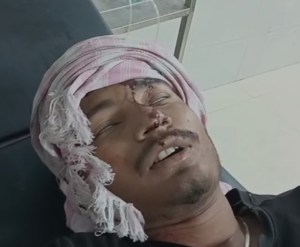 भोजपुर में इंस्टाग्राम पोस्ट को लेकर एक लड़के की बुरी तरह पिटाई