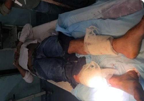 चौपाटी रेस्टोरेंट मालिक की हत्या के मुख्य आरोपी की पुलिस मुठभेड़ ढेर