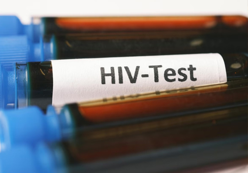 चाईबासा में 5 थैलेसीमिया पीड़ित बच्चों को चढ़ाया HIV पॉजिटिव खून