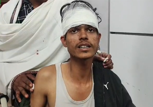 जमशेदपुर के टेल्को में धारदार हथियार से हमला, CCTV खंगाल रही पुलिस